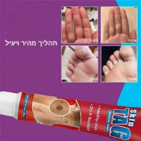 קרם להסרת שומות ויבלות