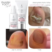 Pharm Foot | reCONSTRUCTOR- ריקונסטרוקטור- ערכה לשחזור ושיקום מבנה הציפורן