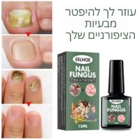 בעיות-ציפורניים-פטרת