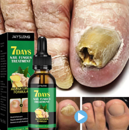 ציפורניים בריאות עם שמן NailCare