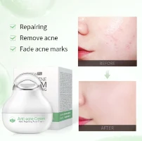 Anti Acne - משחה לטיפול באקנה