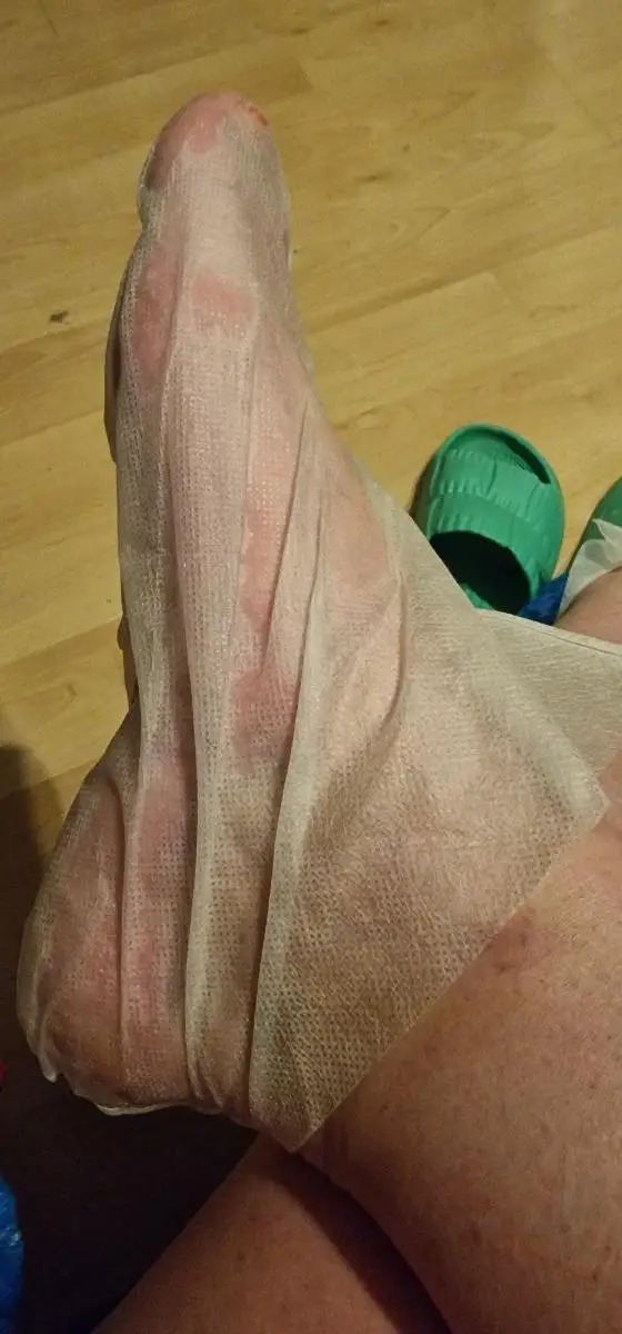 חוות דעת - מסכה טיפולית לרגליים -  Foot Mask