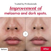 K-Serum סרום קוריאני לתיקון טקסטורת העור