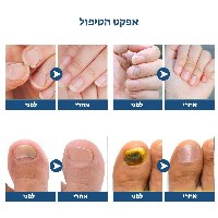 Magic stickers-מדבקות ג'ל לטיפול בפטרת