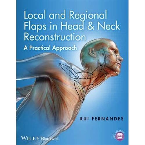 Local and Regional Flaps in Head and Neck Reconstruction : A Practical Approach
