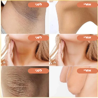 סבון כורכום מוצק לניקוי ושיקום העור