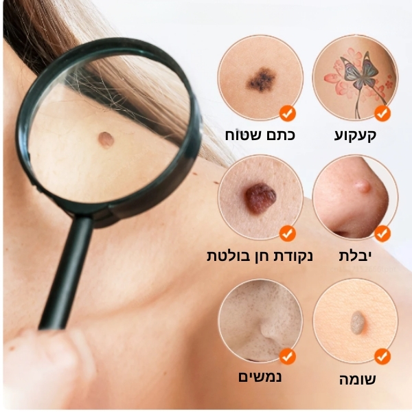 הסרת-כתמים-נמשים