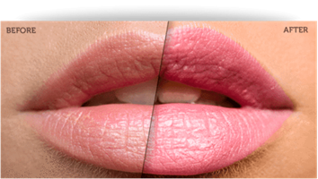 גלוס מילוי שפתיים - Lip Plumping Magical