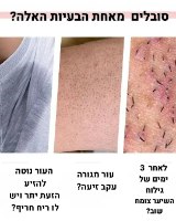 רול און לנטרול זיעה