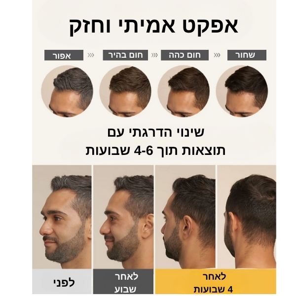 שיער-סרום-לבן