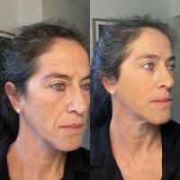 פריימר חדשני לטשטוש קמטים מיידי מבית Peter Thomas Roth