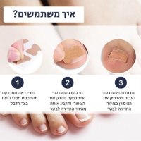 מדבקה-להקלה-בציפורן-חודרנית