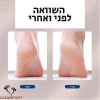 מכשיר-פדיקור-אוטומטי-חשמלי