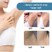 קרם להבהרת כהויות עור