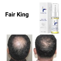 שמן הפלא לעידוד צמיחת שיער FAIR KING