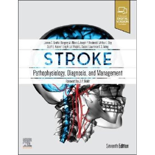Stroke : Pathophysiology, Diagnosis, and Management