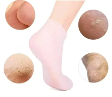 זוג גרבי לחות מסיליקון לטיפול ברגליים יבשות