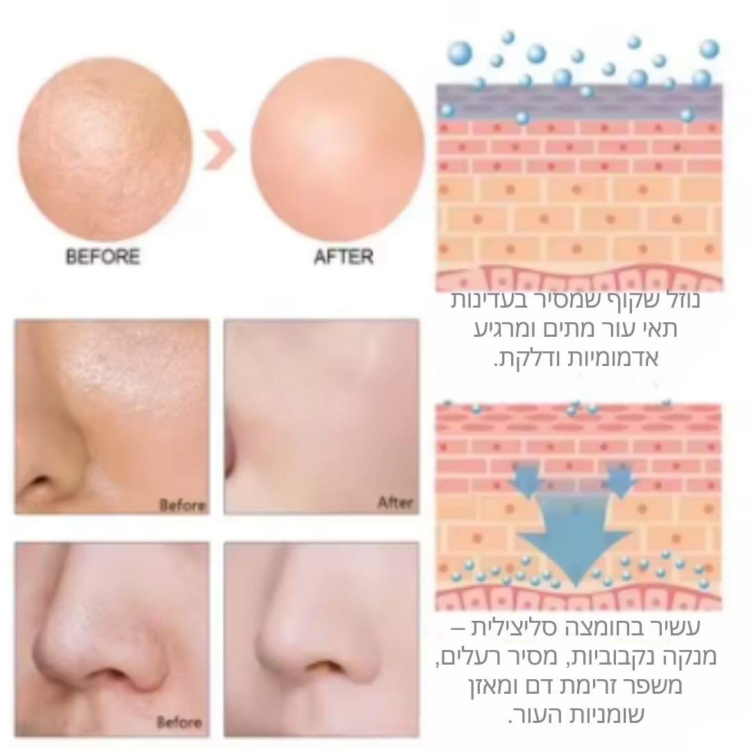 רכיבי הסרום הקוריאני - חומצה לקטית פעילה