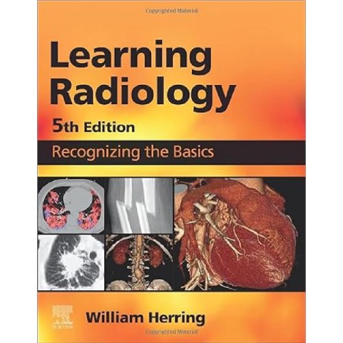 Learning Radiology Recognizing the Basics