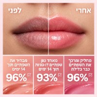 סרום שפתיים טבעי ללחות, נפח וגוון חושני – Barvena Lip