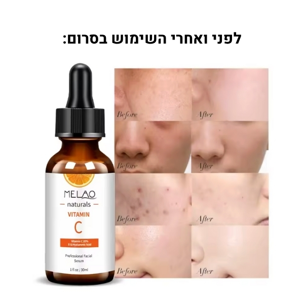 סרום ויטמין C עוצמתי לעור זוהר, אחיד וצעיר – MELAO Naturals (7)