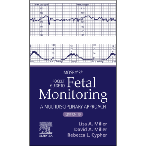 Mosby’s® Pocket Guide to Fetal Monitoring