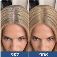 ערכה-לכיסוי-צביעת-שורשים-מהיר-עמיד-יום-שלם-לפני-ואחרי