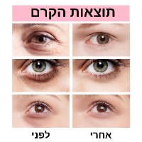 קרם עיניים אנטי-אייג'ינג להסרת כהויות וקמטים