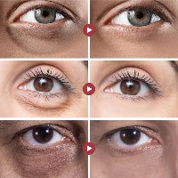 קרם עיניים טיפולי להפחתת כהויות ומיצוק העור