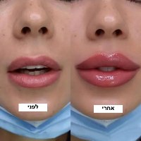 שפתון PLUMP לניפוח ועיבוי השפתיים