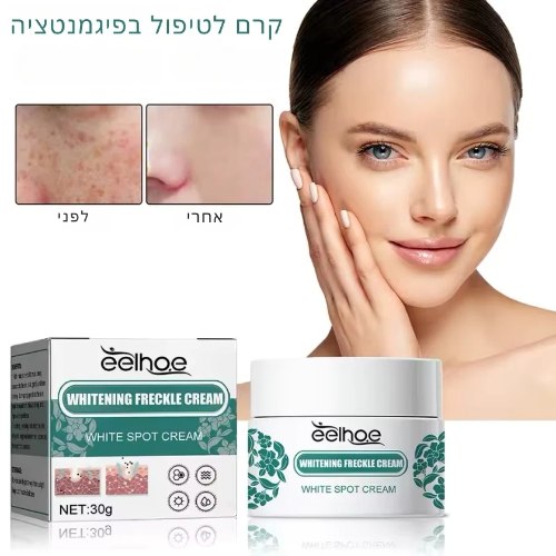 קרם לטיפול בפיגמנטציה