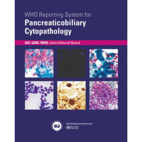 WHO Reporting System for Pancreaticobiliary Cytopathology