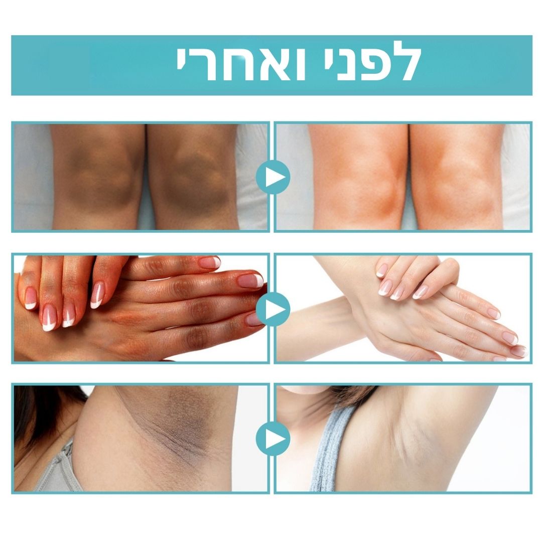 שימוש בקרם גוף להבהרת כתמים