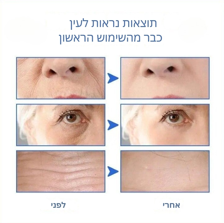 תוצאות הסרום