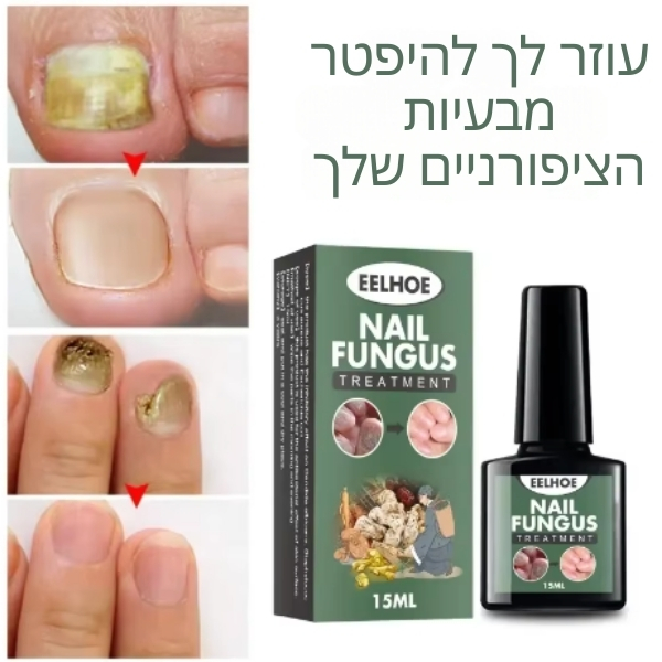 בעיות-ציפורניים-פטרת