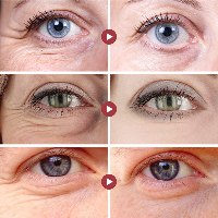 RETINOL סטיק למיצוק העור סביב העיניים