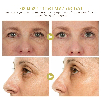 סטיק חלזונות קוריאני לטיפול בכהויות- OUHOE