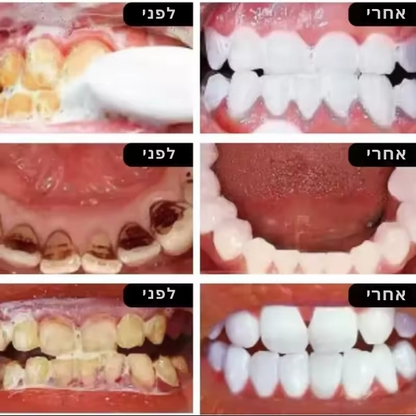 אבקת-הלבנת-שיניים-8