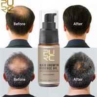PURC -סרום לעידוד צמיחת השיער