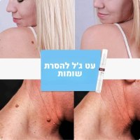 עט-ג׳ל-להשרת-שומות