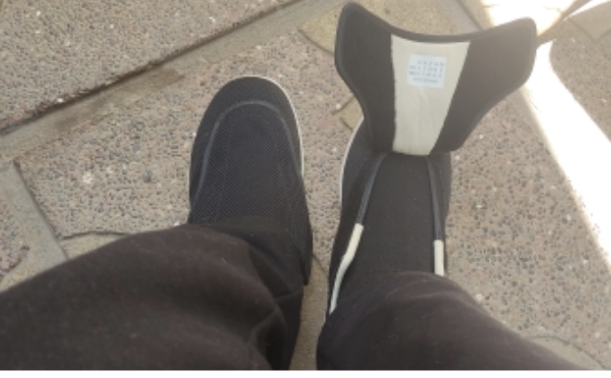 חוות דעת - נעליים לרגליים נפוחות OpenShoes