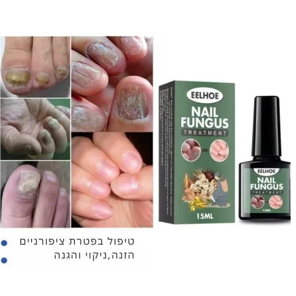 לק-ציפורניים-פטרת