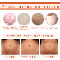 2 יחידות-שמן להסרת סימני מתיחה