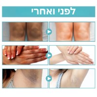 קרם להבהרת כתמים כהים ולטיפול בפיגמטציה