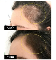 קונסילר למילוי שורשים וכיסוי שיער לבן
