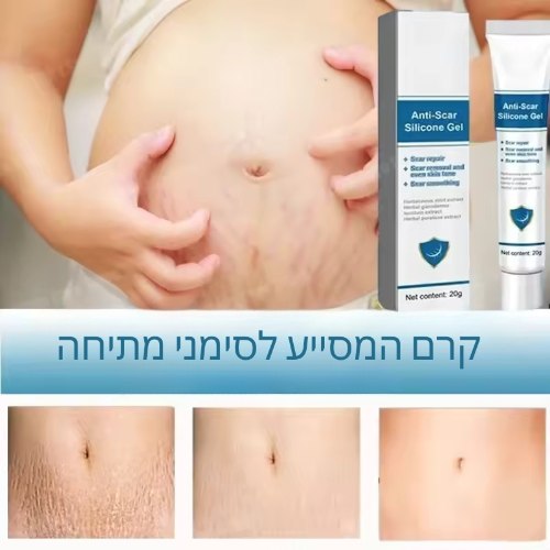קרם המסייע לסימני מתיחה