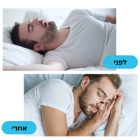 SnoreFree – מדבקות מגנטיות לשינה חלקה ונשימה קלה