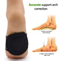 זוג רצועות להקלת כאב בכף הרגל