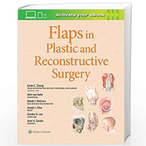 Flaps in Plastic and Reconstructive Surgery