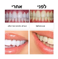 ערכת ג'ל חמצן להלבנת שיניים